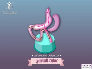 عملية -الساسى-سعرها