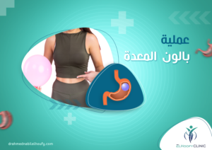 عملية- بالون- المعدة