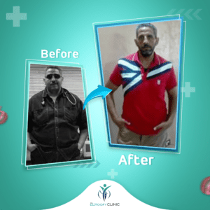 نجاح-عملية-تحويل-مسار