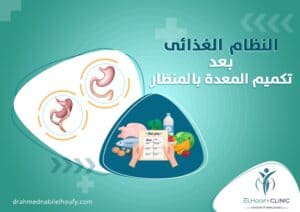 نظام- الأكل -بعد- عملية -التكميم