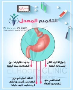 عملية-التكميم-المعدل
