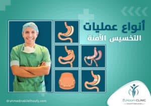 أنواع_عمليات_التخسيس