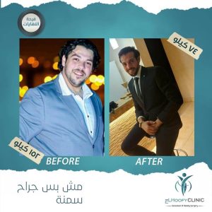 مريض-تكميم-المعدة