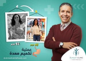 تكميم-معدة-بالتقسيط