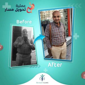 دكتور-تحويل-مسار