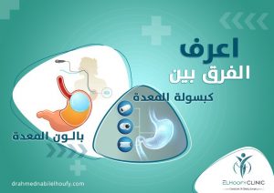 فروق-الكبسولة-والبالون
