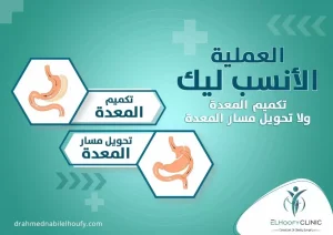 تكميم-المعدة-بدون-جراحة