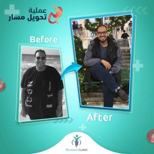 تحويل-مسار-مصغر-وسعره