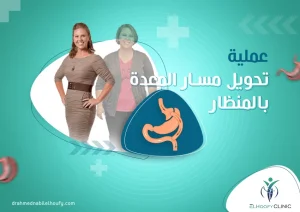 عملية-تحويل-المسار-وسعرها