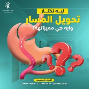مميزات-تحويل-المسار