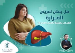 هل-يمكن-لمريض-المرارة-القيام-بعملية-تكميم-المعدة؟