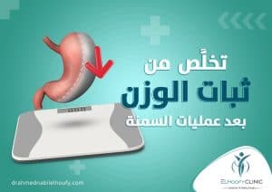 ثبات -الوزن-بعد-عملية-التكميم
