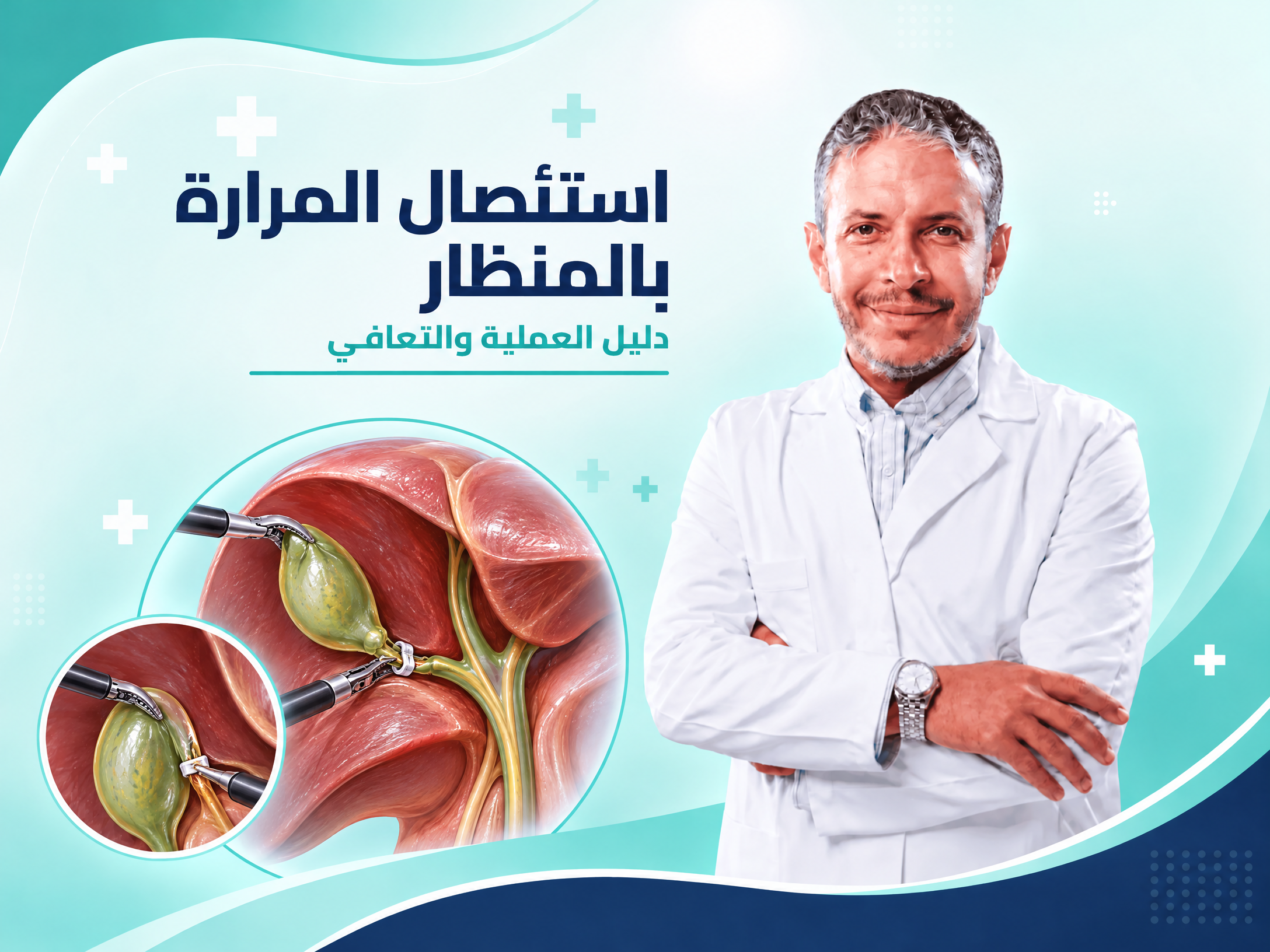 إستئصال المرارة بالمنظار