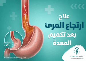 علاج-ارتجاع-المرئ بعد-تكميم-المعدة