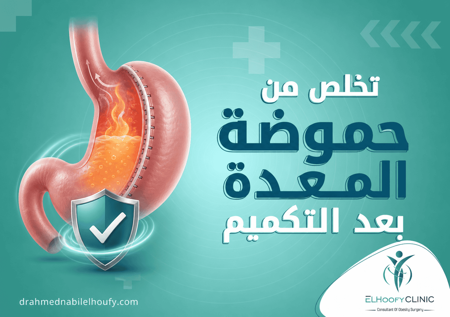 تخلص من حموضة المعدة بعد التكميم 2026