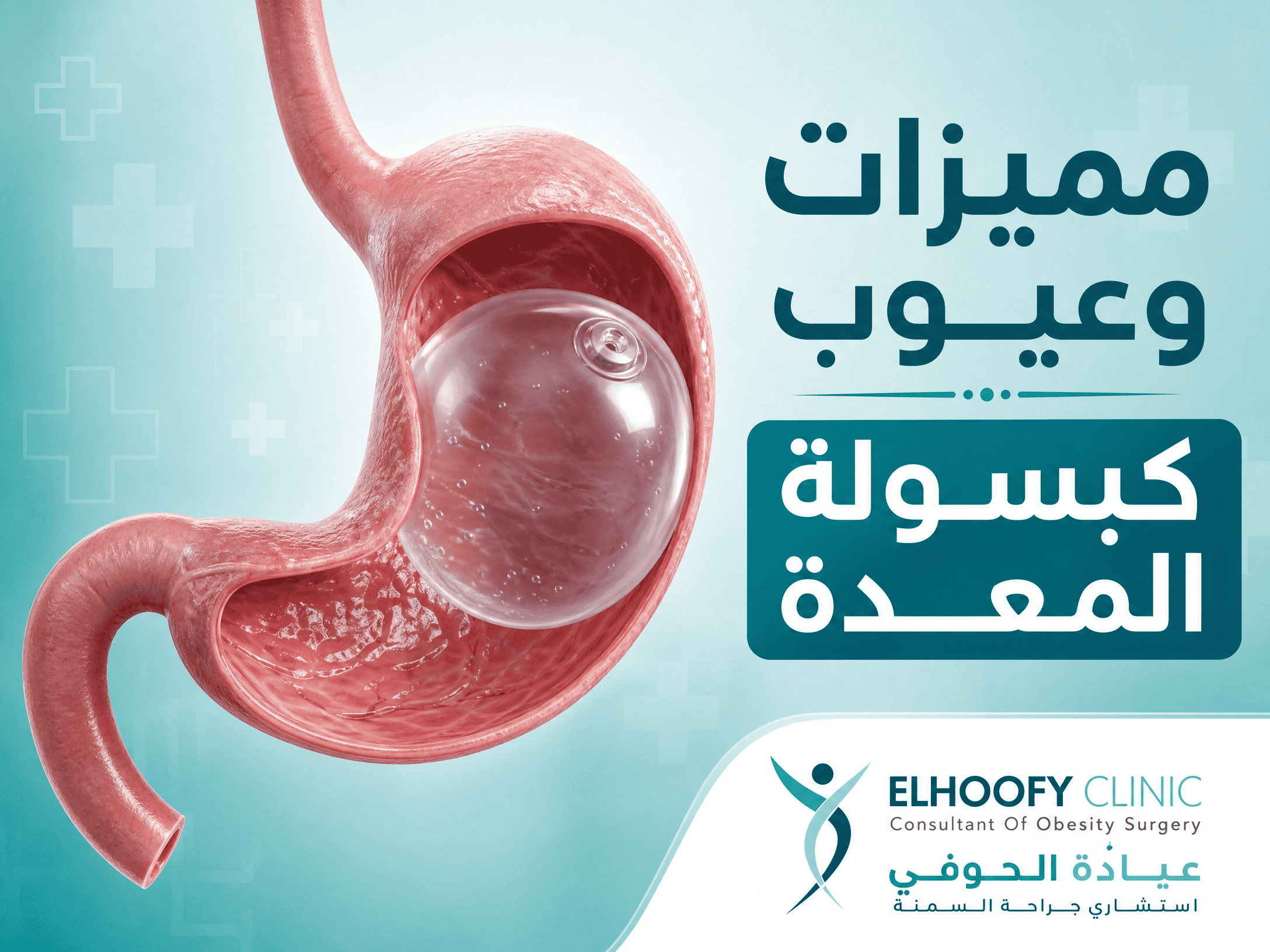 مميزات وعيوب كبسولة المعدة الذكية؟