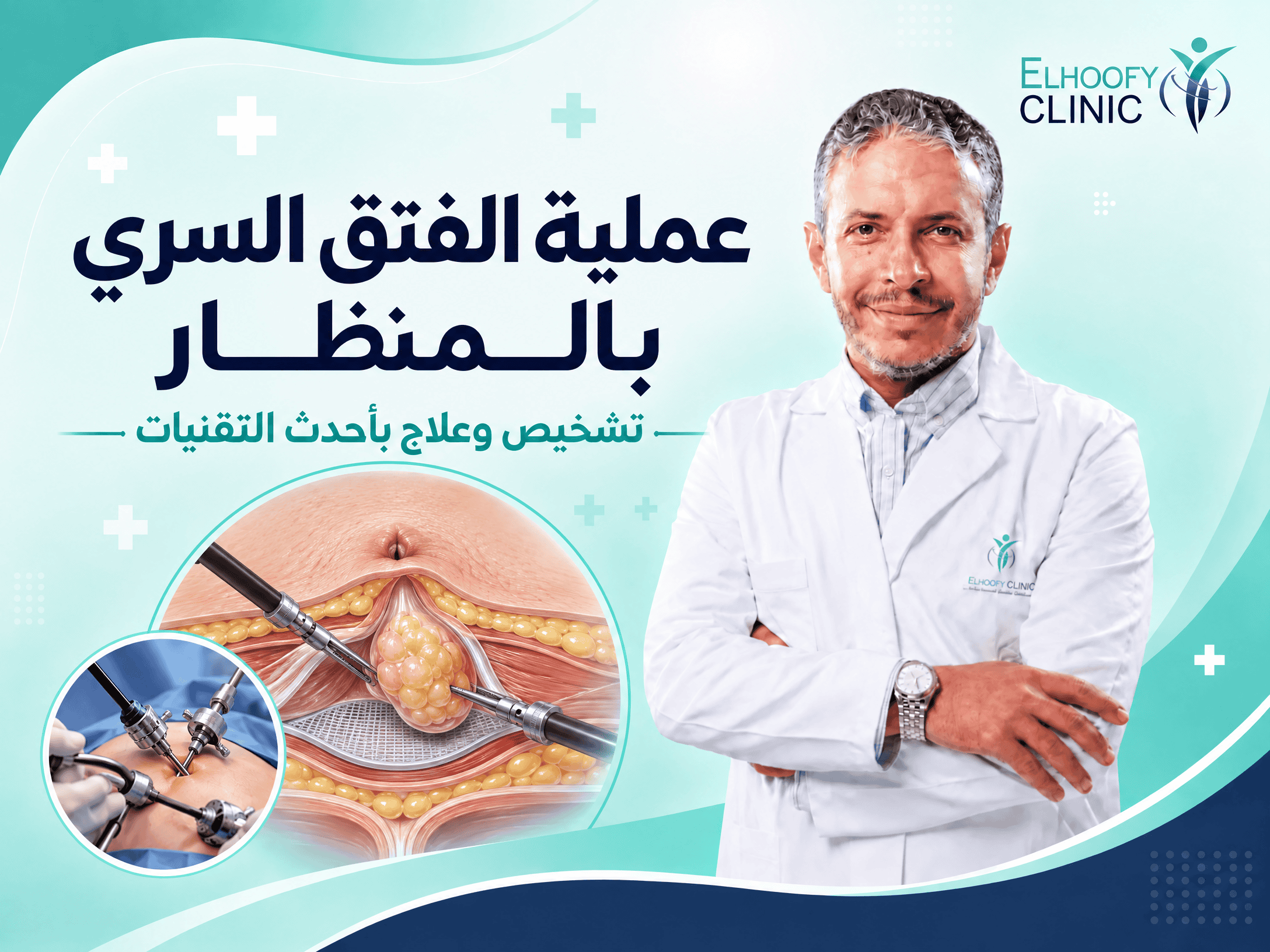 إصلاح الفتق السري بالمنظار